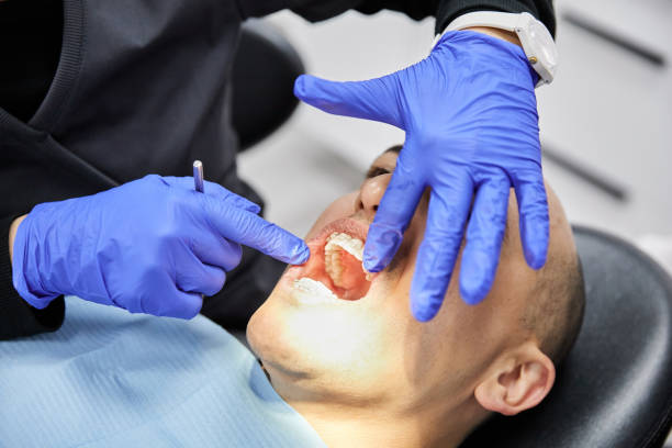 Best Emergency Dentist for Knocked-Out Tooth in Durham, CA